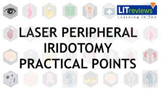 Laser Peripheral Iridotomy Practical Point [upl. by Drescher]