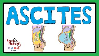 ASCITES  Serum Ascites Albumin Gradient SAAG  Ascites Pathophysiology  Ascites Causes [upl. by Sauls]