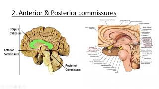 Neuroanatomy Cerebrum White Matter [upl. by Jerol]