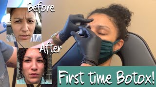 Getting Botox for the First Time for Glabella lines Eleven 11 lines [upl. by Brigida95]