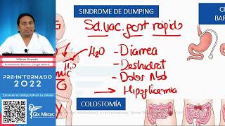 CIRUGIA BARIATRICA  Gastrointestinal  QX MEDIC  Cirugía Medica [upl. by Lynden455]