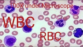 How to WBC count under Microscope [upl. by Dyane]