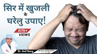 सिर में खुजली  5 बड़े कारण  Itchy Scalp Problem  Treatment  Head Itches Even After Washing Hair [upl. by Perlie]