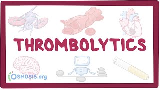 Thrombolytics pharmacology [upl. by Cheyne]