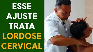 ESSE AJUSTE TRATA LORDOSE CERVICAL [upl. by Nowyt]