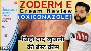 दाद खुजली की सबसे इफेक्टिव क्रीम 🔥 Zoderm E Cream Uses amp Side Effects In Hindi Oxiconazole [upl. by Hercules576]