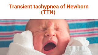 Transient Tachypnea of the Newborn [upl. by Landre932]