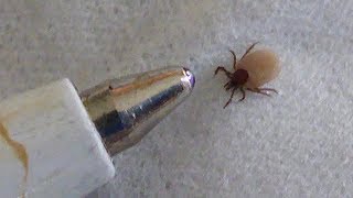 HILFE EINE BABYZECKE Ein ErsteHilfeRatgeber Removing a tick 1080p [upl. by Neeoma]