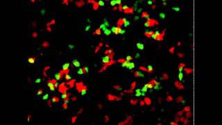 Twophoton microscopy of Bone marrow derived DCT cell interaction [upl. by Atiuqrahs171]