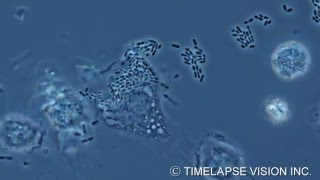 Bacterial phagocytosis by macrophage マクロファージによる細菌の貪食 [upl. by Uyr]