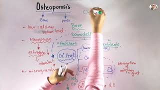 Osteoporosis in Urdu\Hindi  Biomechanics of human bone growth and development [upl. by Ahsirahc]