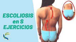 ESCOLIOSIS en S  EJERCICIOS evitar DOLOR y CORREGIR  Fisiolution [upl. by Renzo]