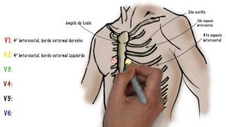 Como hacer un ECG electrocardiograma [upl. by Anikram656]