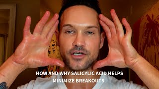 HOW AND WHY SALICYLIC ACID IS ONE OF THE BEST INGREDIENTS TO HELP MINIMIZE BREAKOUTS [upl. by Annabel]