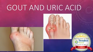 Gout and Hyperuricemia [upl. by Ireg]