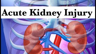 Acute Kidney Injury AKI by ASM Minds Team [upl. by Karil]