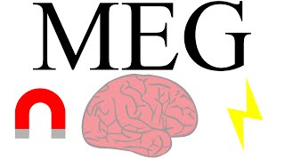 Magnetoencephalography measuring brain activity with magnetism [upl. by Aicatsue]