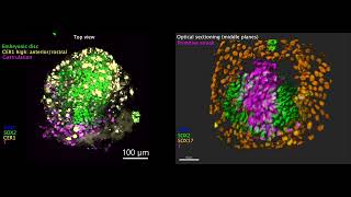 Researchers generate human embryolike structures that include extraembryonic tissue [upl. by Nilson]