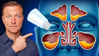 Rid Throat and Sinus Mucus with SALT [upl. by Oironoh]