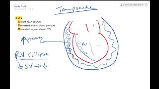 Cardiac Tamponade  Dr Jamal USMLE [upl. by Lisab]