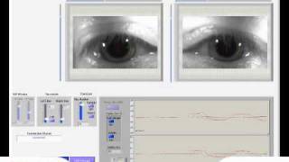 Eye Video Smooth Pursuit Vertical 5Hzwmv [upl. by Tewell]