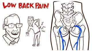 Low Back Pain [upl. by Kcirednek]