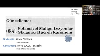 ODMFR Oral Potansiyel Malign Lezyonlar Oral Skuamöz Hücreli Karsinom [upl. by Harper767]