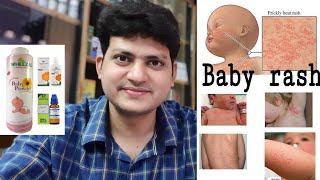 Common Childhood rashes  Homeopathic Medicine for baby rashes  Baby acne Nappy rash [upl. by Viglione]