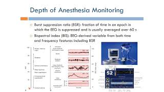 Anesthesia Depth of Anesthesia Monitoring English Narration [upl. by Jandy]