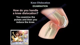 Knee Dislocation  Everything You Need To Know  Dr Nabil Ebraheim [upl. by Eelarol]