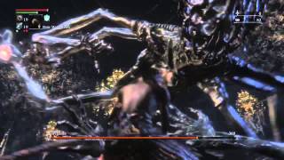 Bloodborne Defiled Chalice Amygdala Strategy Boss Guide [upl. by Cai]