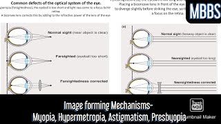 Image forming Mechanisms Myopia Hypermetropia Astigmatism Presbyopia mbbs medicine next neet [upl. by Dominga]