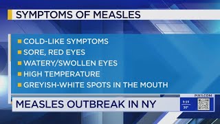 Measles outbreak in 2024 surpasses number of cases in 2023 CDC [upl. by Nuahsak]