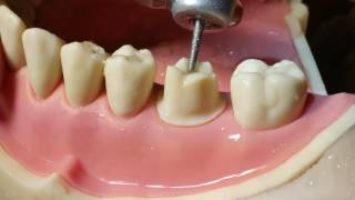 Molar Crown Preparation Walkthrough tutorial in the Simulation Lab [upl. by Eciral]