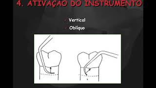 Aula Instrumentação parte 2 [upl. by Marget492]