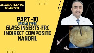 10  Pushing the Boundaries of Composites Glass Inserts Nanofillers Indirect Techniques amp More [upl. by Elletnahc]