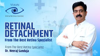 Retinal Detachment  Introduction and Treatment by Dr Neeraj Sanduja  Viaan Eye amp Retina Centre [upl. by Inimod846]