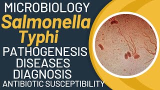 Salmonella typhi microbiology  Typhoid fever pathogenesis by salmonella typhimurium [upl. by Abeu419]