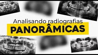 Analisando radiografia panorâmica  RADIOLOGIA [upl. by Ylra]