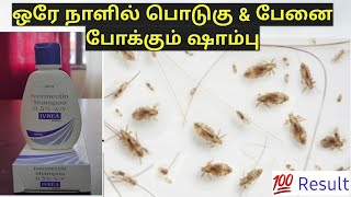 ஒரே நாளில் பேன் பிரச்சனை தீர  Ivrea Shampoo  Get Rid Of Lice amp Dandruff In Tamil haircare [upl. by Charissa]