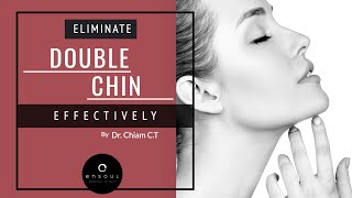 Types of Double Chin amp Your Treatment Options  Dr Chiam CT [upl. by Antin]