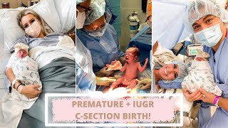 BLAKELYS BIRTH STORY  IUGR PREEMIE   RAW EMOTIONAL FOOTAGE   C SECTION [upl. by Ennirac]