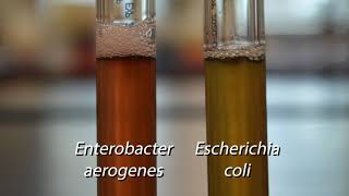 Demo Biochemical Tests  Voges Proskauer Test [upl. by Luciana57]