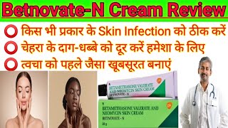 BetnovateN। BetnovateN Skin cream review 2023। How to uses betnovate n skin cream on face। [upl. by Ubald705]