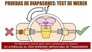 EXAMEN FÍSICO  EXAMEN OTOLÓGICO OTOSCOPÍA Y PRUEBAS DE DIAPASONES DE WEBER Y RINNE [upl. by Yuu525]