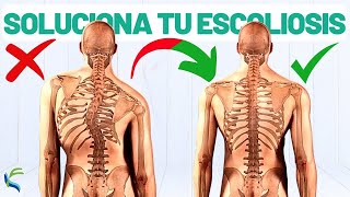 Ejercicios para la Escoliosis en C ▶️ [upl. by Ennahoj]