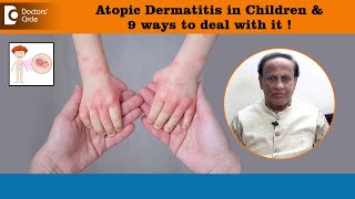 ATOPIC DERMATITIS in Children amp 9 ways to deal this Infantile EczemaDrD A SatishDoctors’ Circle [upl. by Legin]