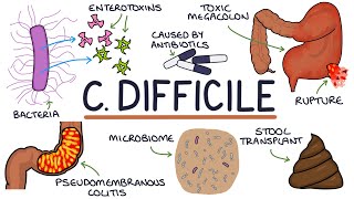 Understanding Clostridium Difficile Infection C Diff [upl. by Haldes216]