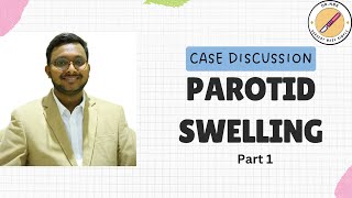 PAROTID SWELLING Case Discussion Part 1Surgery Made SimpleSMS by NBK [upl. by Nirrak735]