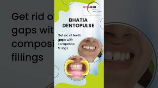 Get rid of Teeth Gaps with Composite Fillings Dr Srishti Bhatia confidentsmile healthysmile [upl. by Wolgast]